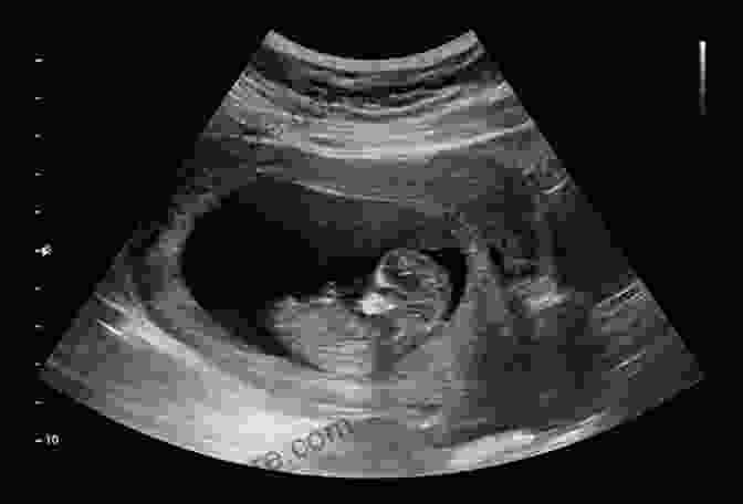 Ultrasound Image Of A Developing Fetus Pregnancy: Expecting A Baby For New Moms (Parenting Baby Guide New Parent Childbirth Motherhood)